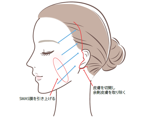 適用部位