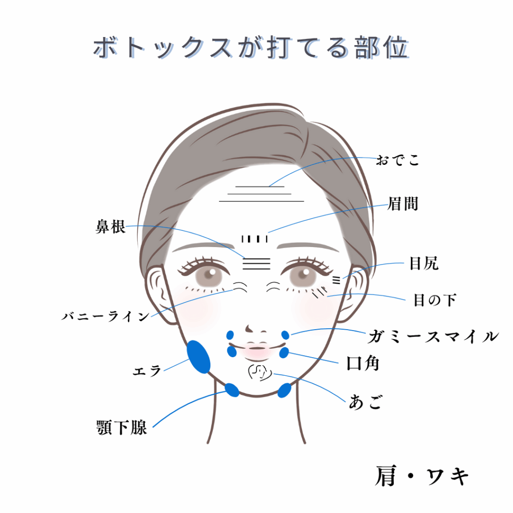 ボツリヌストキシン治療｜大阪梅田YUTAKA美容外科【美容外科、美容皮膚科、形成外科】