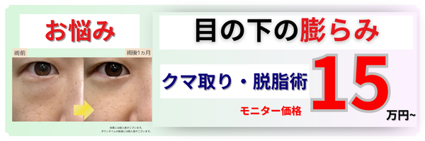 クマ取り・脱脂