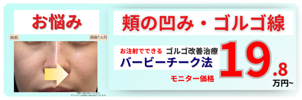 ゴルゴライン改善治療・バービーチーク
