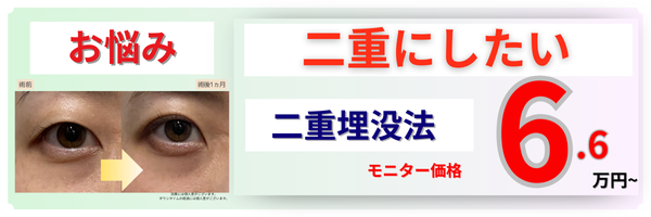 二重埋没法