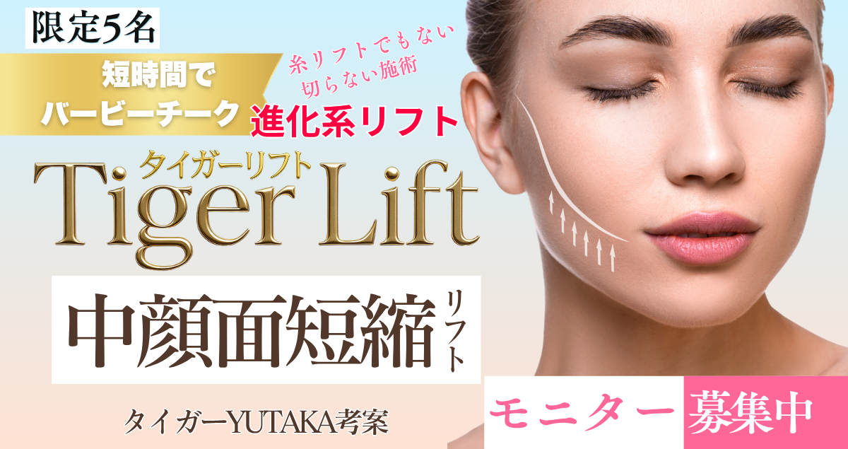 バービーチーク・タイガーリフトは切らない中顔面短縮リフトでメス・糸を使わない画期的なリフト術
施術時間もわずか２０分
