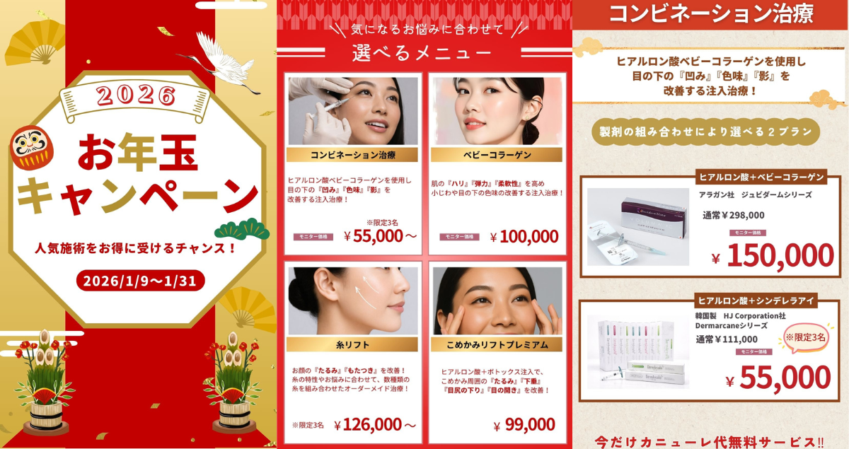 2026年お年玉キャンペーン