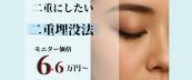 バナー二重埋没６００×２５０